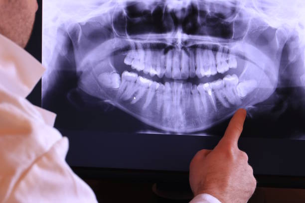 Best Emergency Root Canal Treatment in Litchfield, IL